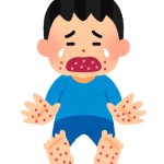 手足口病で熱なしのときは要注意！熱が出ないときの判断の仕方！