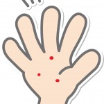 ヘルパンギーナの薬で大人と子供向け!痛み止めや抗生物質など!