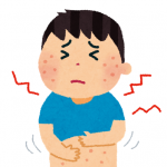日焼けによる湿疹とかゆみの治療法と注意点！子供への対処法も！