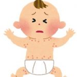 赤ちゃんの突発性発疹は大人にうつる？感染経路や症状！兄弟は？