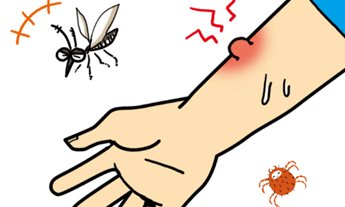 虫刺されに対してアレルギーがある場合の対処法を確認する