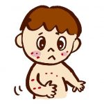 アデノウイルスで喉の痛みや咳が止まらない時の原因と対処法!