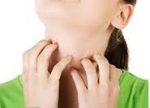 首の蕁麻疹はストレスが原因？痒くない時は？対処法と注意点！